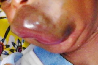Côte d'Ivoire: Des cliniques privées à  la base de cancers et d'anomalies génétiques